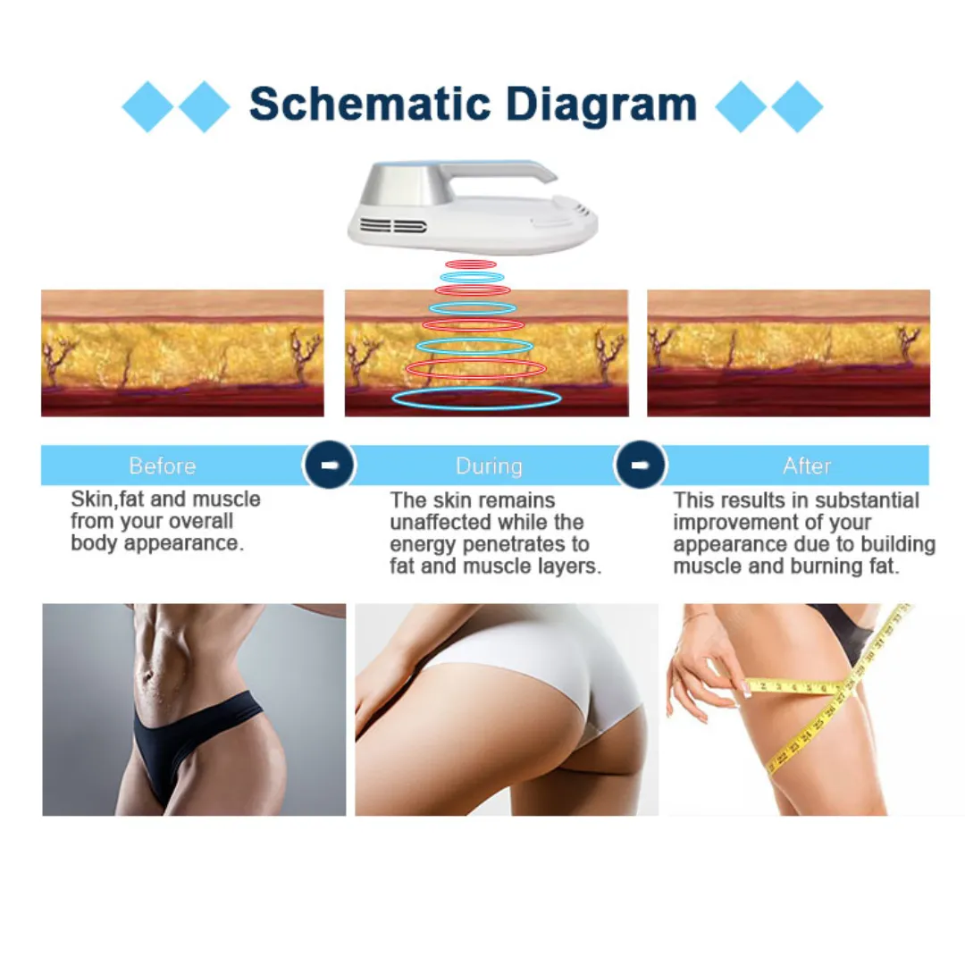 EMShape Neo® Elite with Upgraded Higher Power